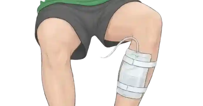 Leg bag illustration